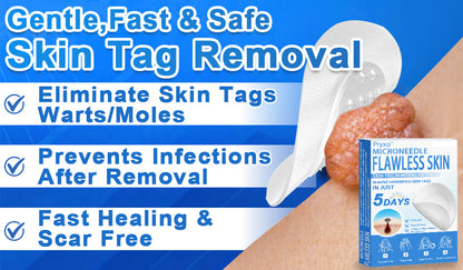 👨‍⚕️ Pryxo™ 2-in-1 Microneedle & Hydrocolloid Patch | Raised Moles,Acne,  Flat Warts & Skin Tags Remover | Improves Wrinkles, Scars & Blemishes | Invisible Pimple Patches for Face & Body