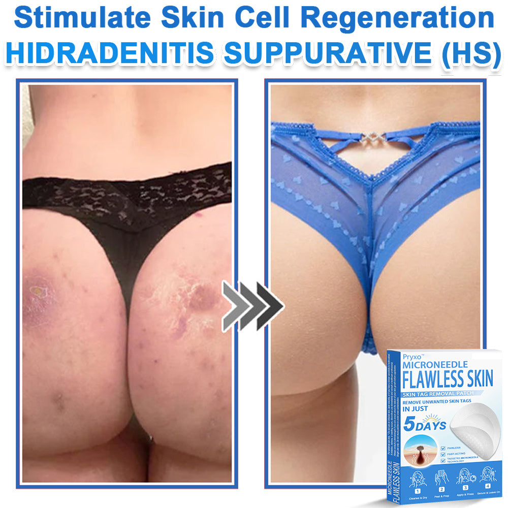 👨‍⚕️ Pryxo™ 2-in-1 Microneedle & Hydrocolloid Patch | Raised Moles,Acne,  Flat Warts & Skin Tags Remover | Improves Wrinkles, Scars & Blemishes | Invisible Pimple Patches for Face & Body