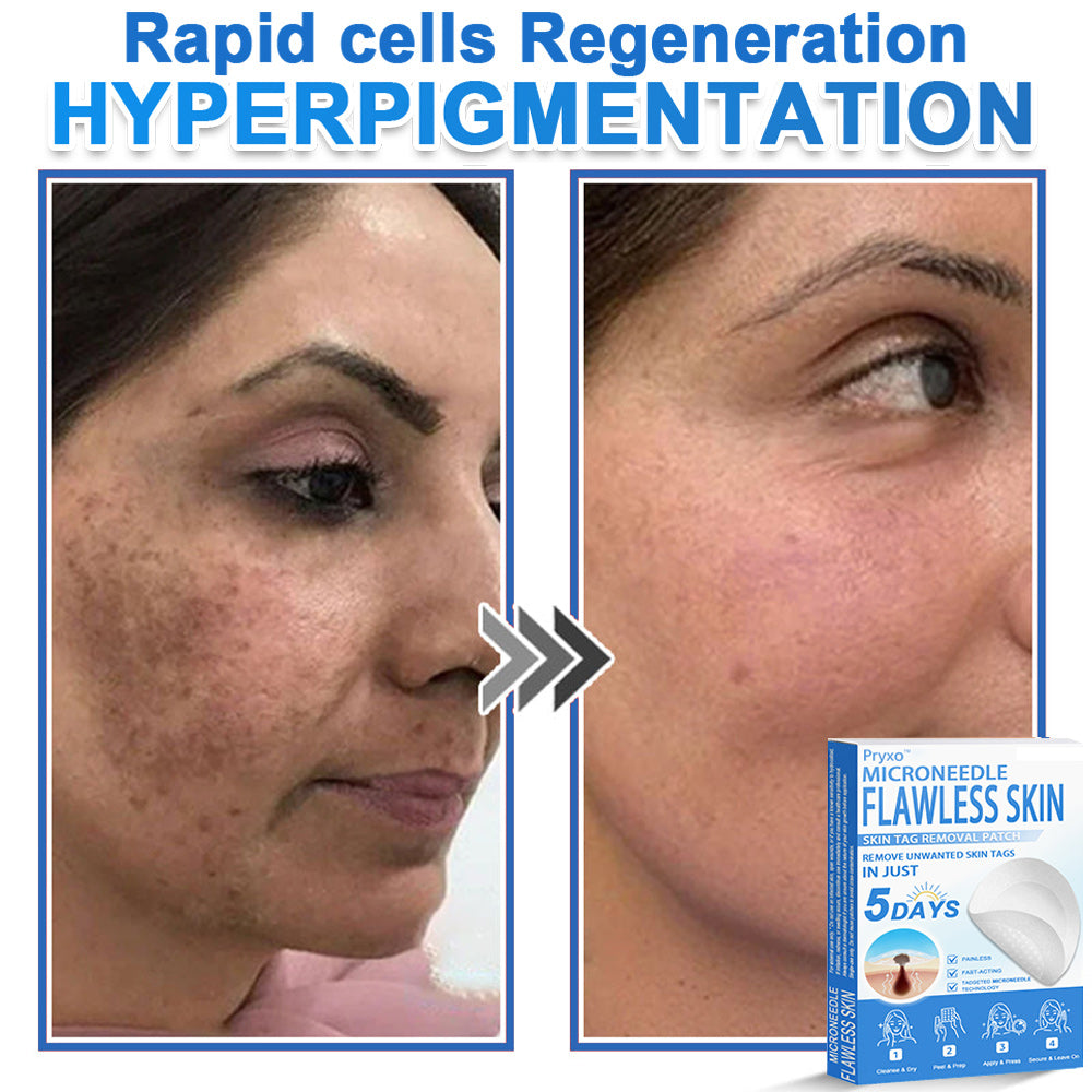 👨‍⚕️ Pryxo™ 2-in-1 Microneedle & Hydrocolloid Patch | Raised Moles,Acne,  Flat Warts & Skin Tags Remover | Improves Wrinkles, Scars & Blemishes | Invisible Pimple Patches for Face & Body