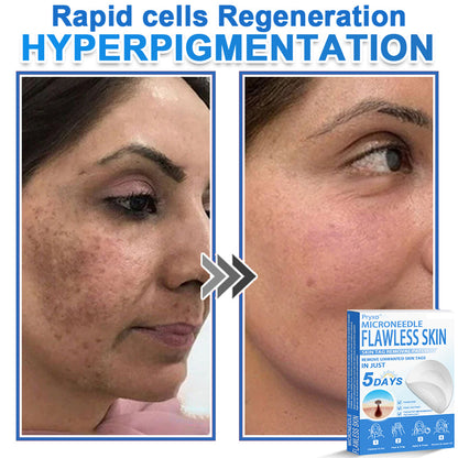 👨‍⚕️ Pryxo™ 2-in-1 Microneedle & Hydrocolloid Patch | Raised Moles,Acne,  Flat Warts & Skin Tags Remover | Improves Wrinkles, Scars & Blemishes | Invisible Pimple Patches for Face & Body