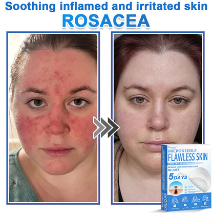 👨‍⚕️ Pryxo™ 2-in-1 Microneedle & Hydrocolloid Patch | Raised Moles,Acne,  Flat Warts & Skin Tags Remover | Improves Wrinkles, Scars & Blemishes | Invisible Pimple Patches for Face & Body